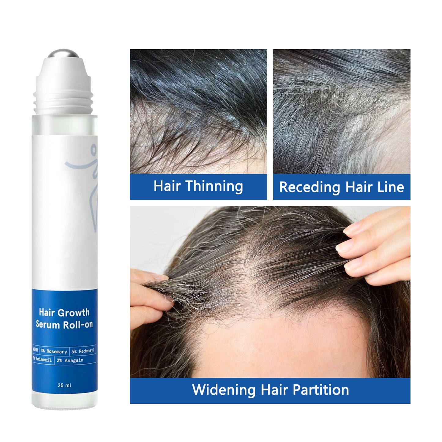 DermaFlow Hair Growth Roll-On